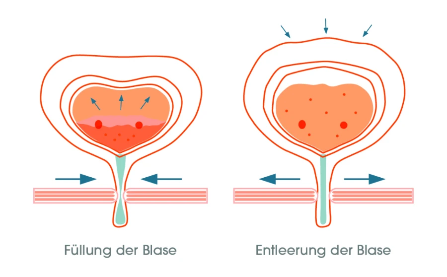 Ständig Druck Auf Der Blase www.ms-begleiter.de