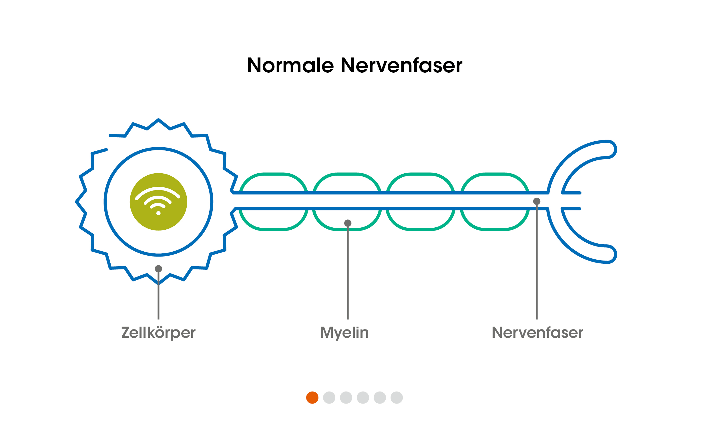 Annimation Nervenfaser bei MS